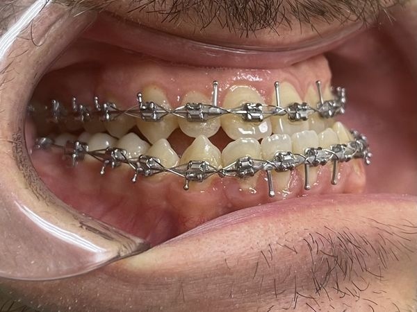 Ситуация перед операцией 