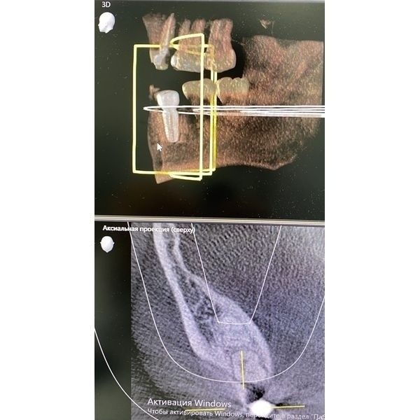 Контрольная КТ Контрольная КТ