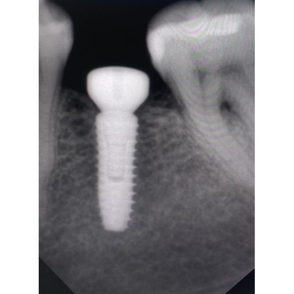 Контрольная визиограмма Контрольная визиограмма