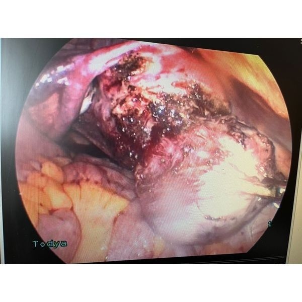 После удаления После удаления