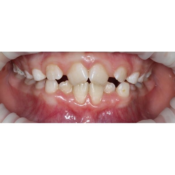 После окончания лечения