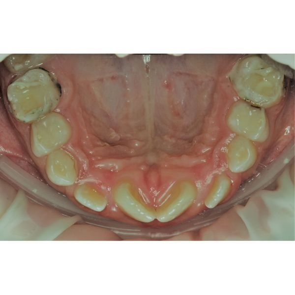 После лечения