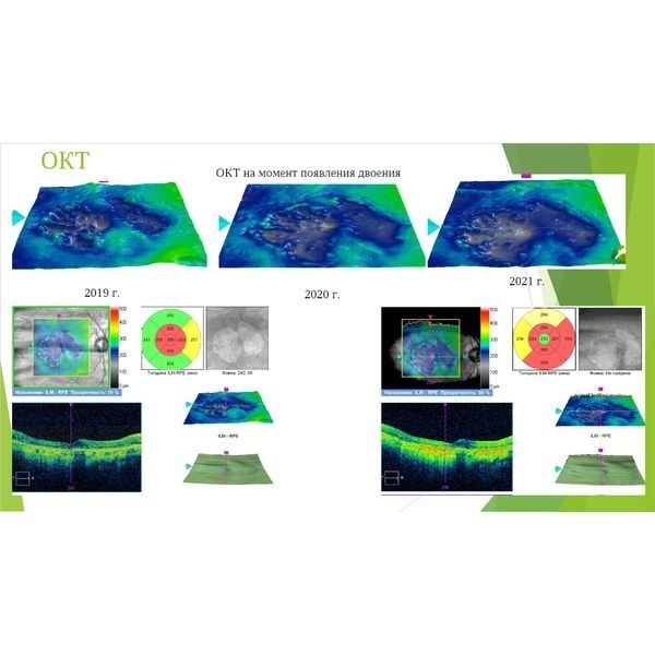 Динамика лечения