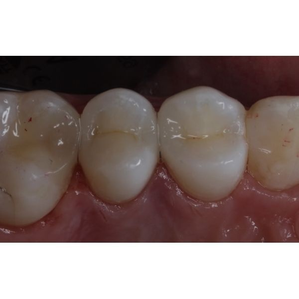 Итоговый результат Итоговый результат