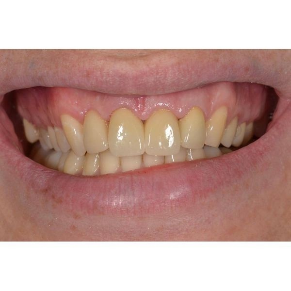 Финальный результат