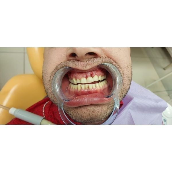 Ситуация через 2 недели после обращения Ситуация через 2 недели после обращения