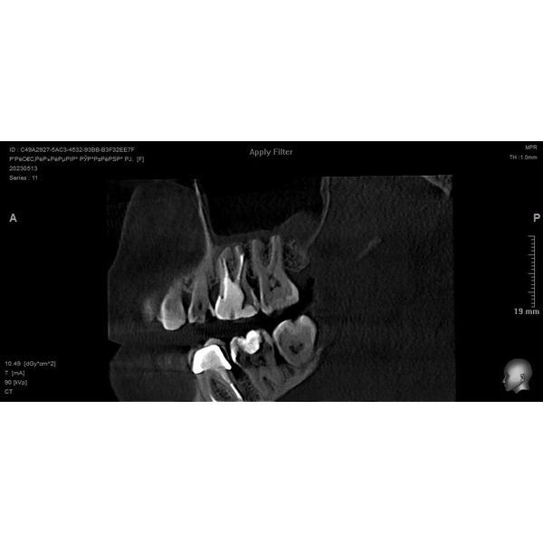ВЧП слева в мае 2023 года