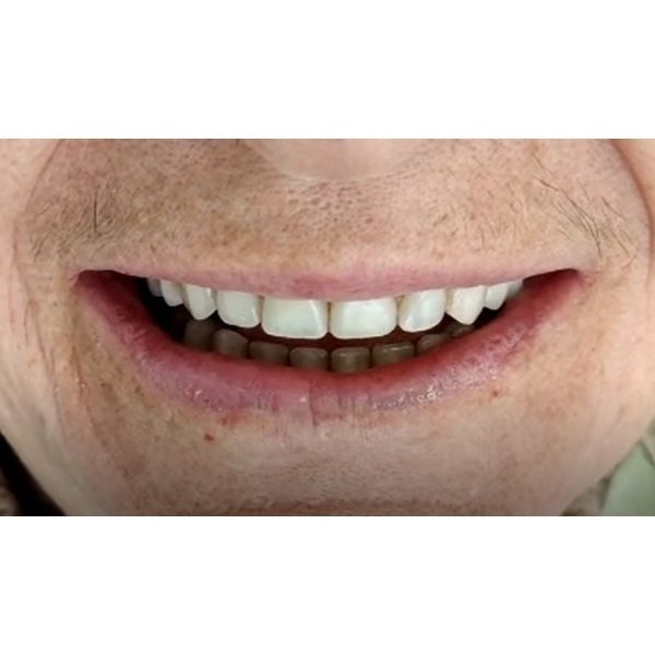 Итог лечения