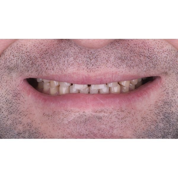 Исходная ситуация (улыбка)