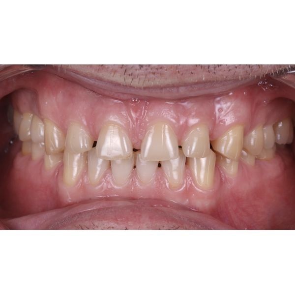 Исходная ситуация