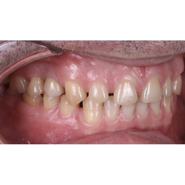 Исходная ситуация