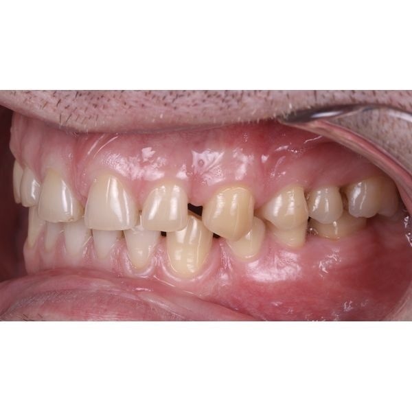 Исходная ситуация