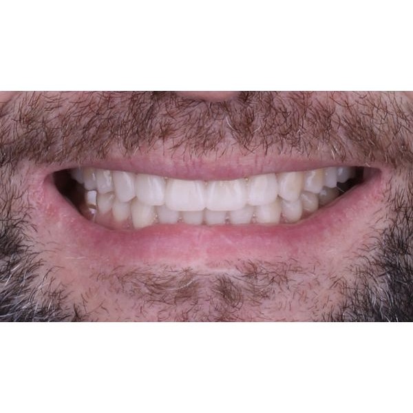 Улыбка с макетом