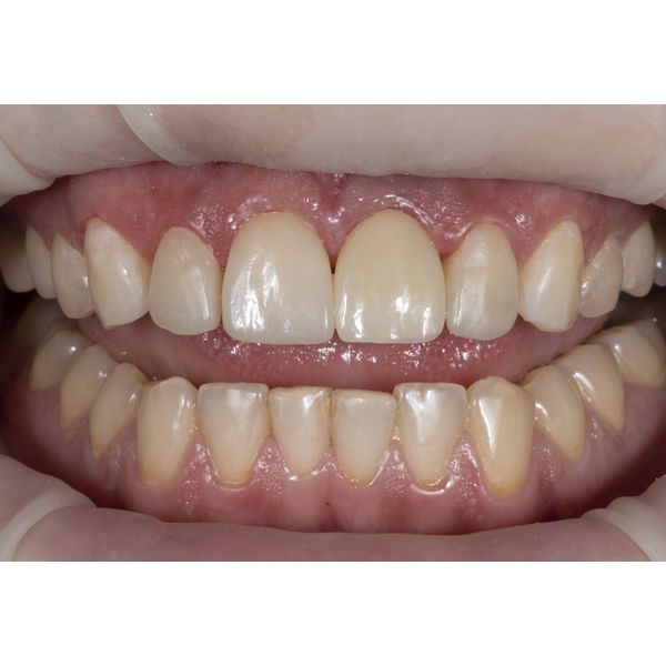 После лечения