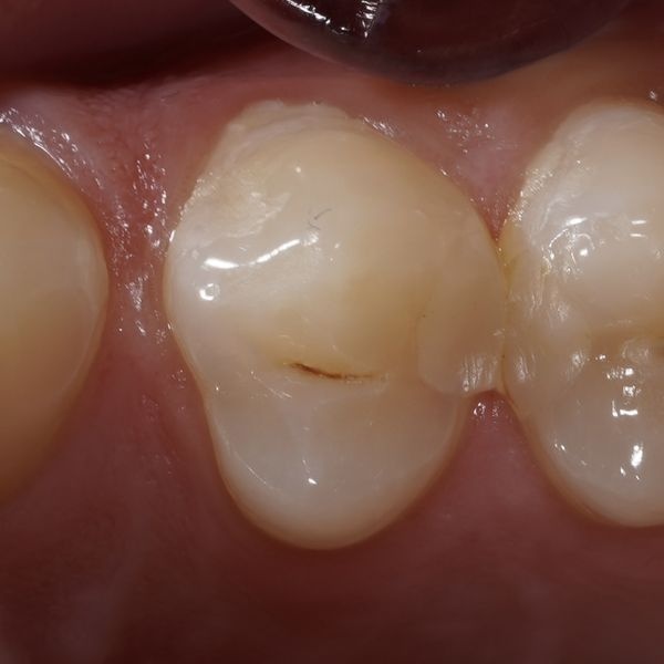 До лечения До лечения