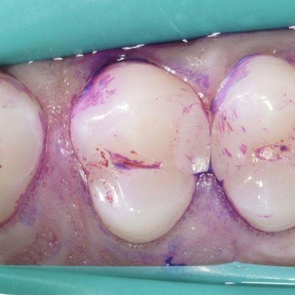 Индикатор налёта Индикатор налёта