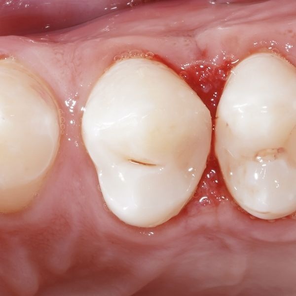 Сразу после реставрации Сразу после реставрации