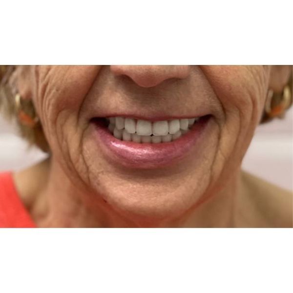 После лечения