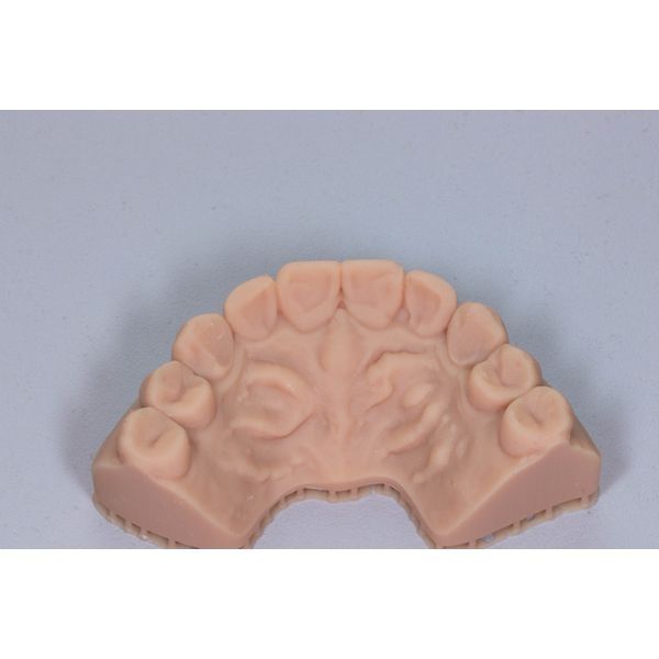 Печатная модель будущей формы и размера зубов