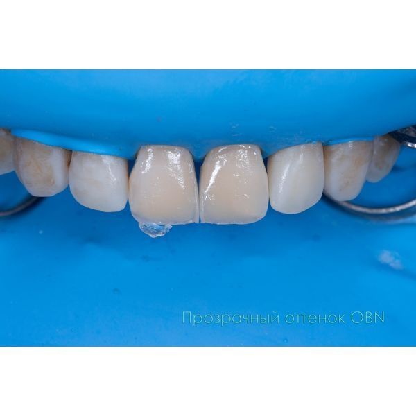 Нанесли прозрачный материал по режущему краю, чтобы придать ему естественность