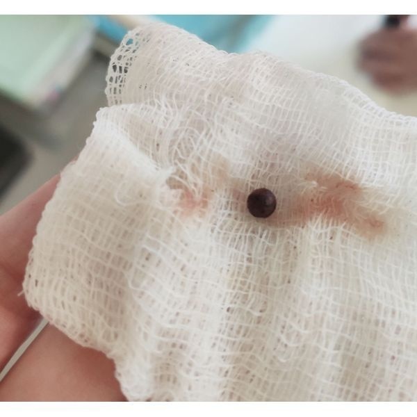 Извлечённая пуля