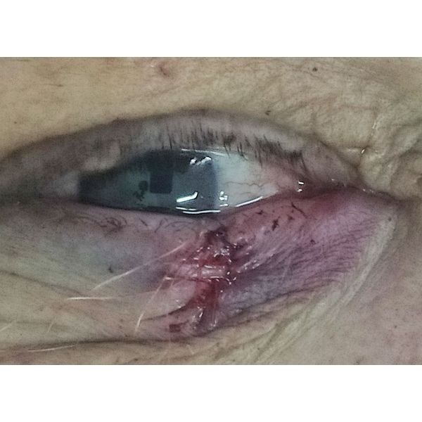 Контрольный осмотр после операции через 3 дня