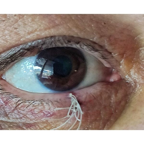 Контрольный осмотр после операции через неделю