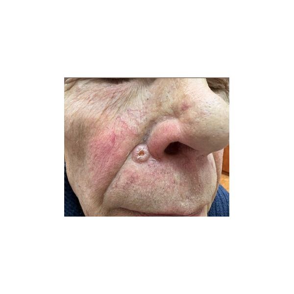 Состояние до лечения 