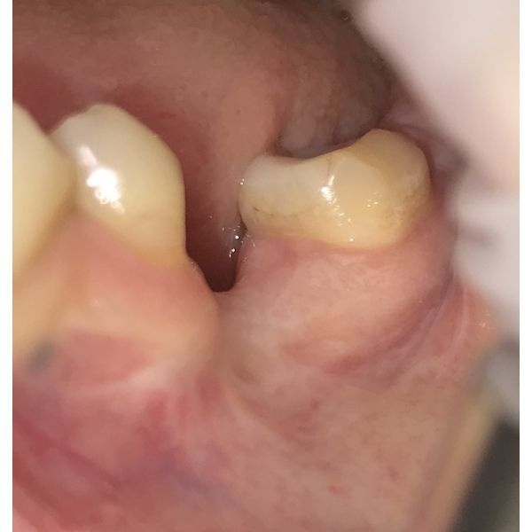 Состояние до лечения