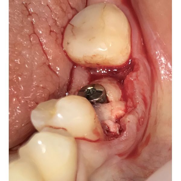 Процесс лечения
