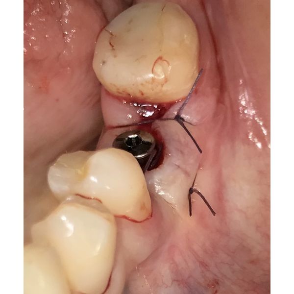 Процесс лечения