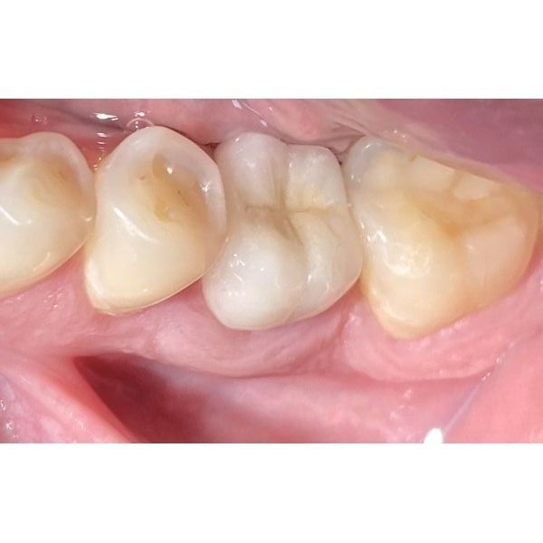 Состояние через 5 лет