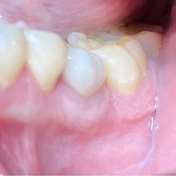 Состояние через 5 лет