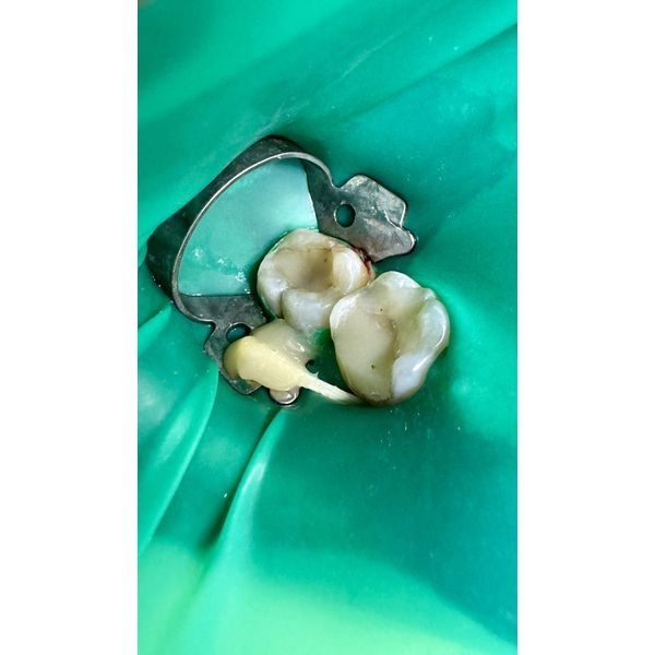 Процесс лечения