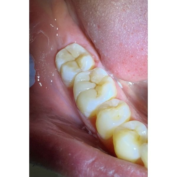 После лечения