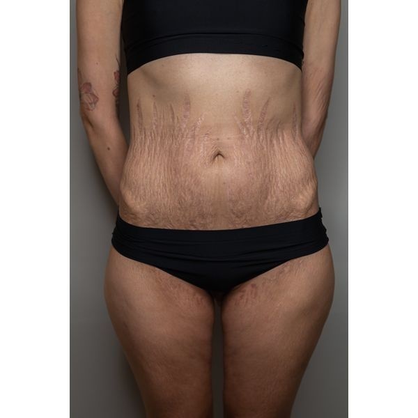 Ситуация до лечения Ситуация до лечения