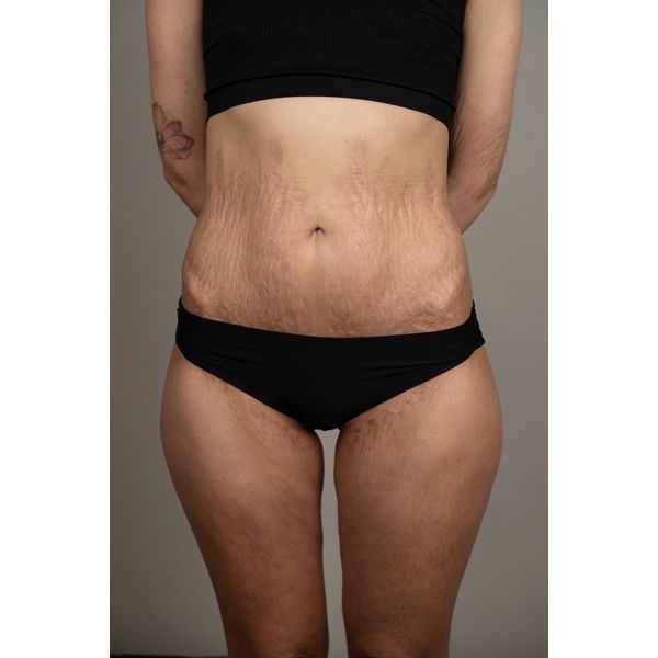 Ситуация после лечения Ситуация после лечения