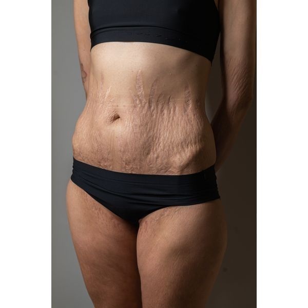 Ситуация до лечения Ситуация до лечения