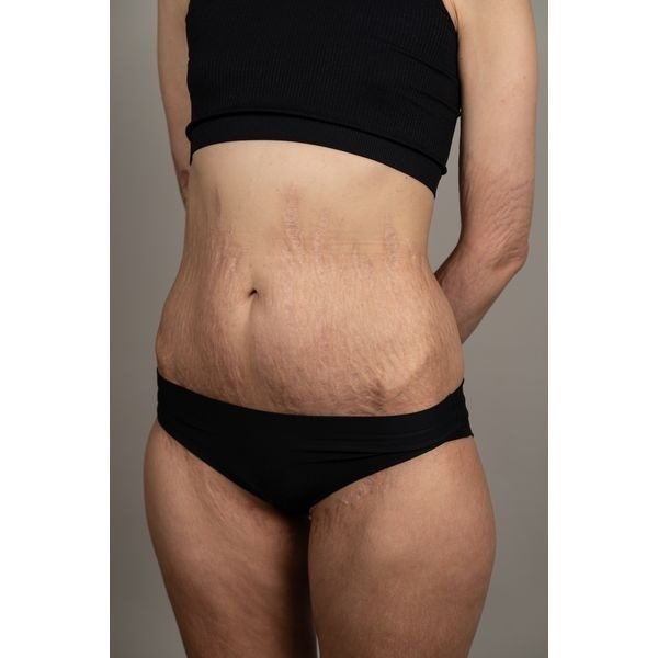 Ситуация после лечения Ситуация после лечения