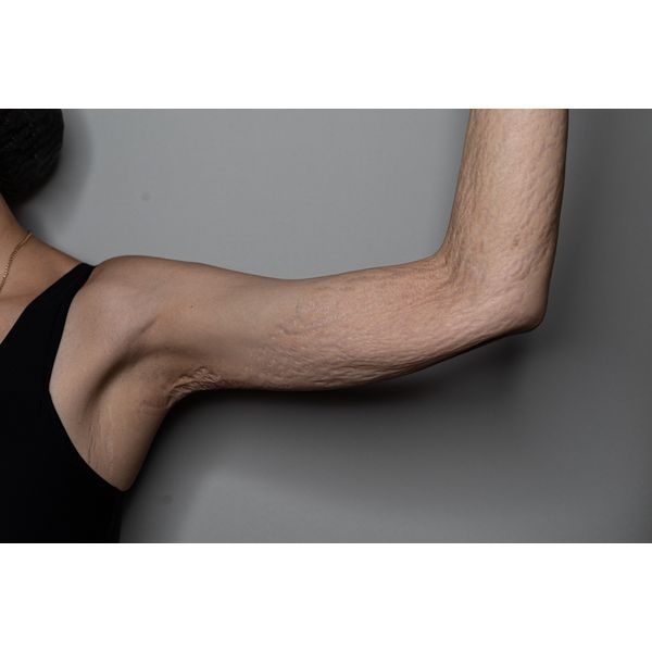 Левая рука до лечения Левая рука до лечения