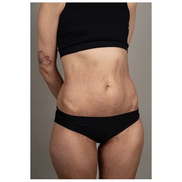 Ситуация после лечения Ситуация после лечения