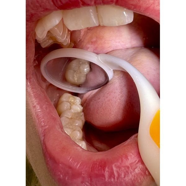 Ситуация до лечения