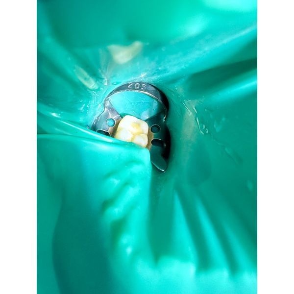 Процесс лечения