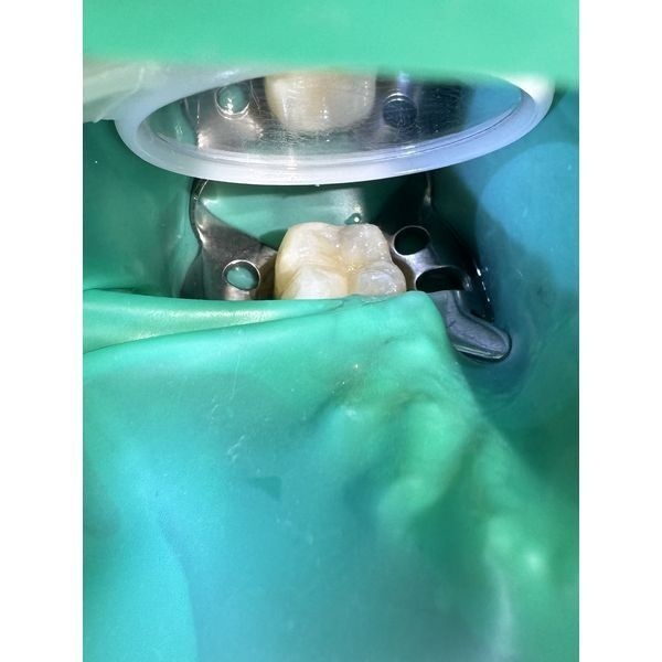 Ситуация после моделирования 