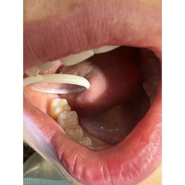 Итог лечения 