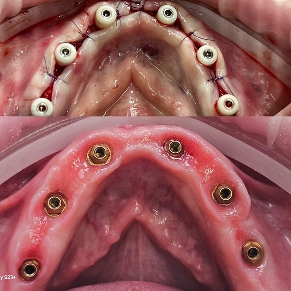 Мультиюниты