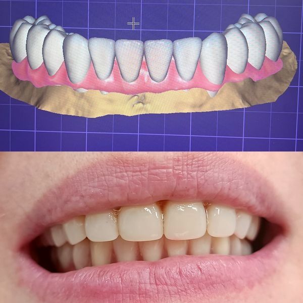 Зубы после лечения