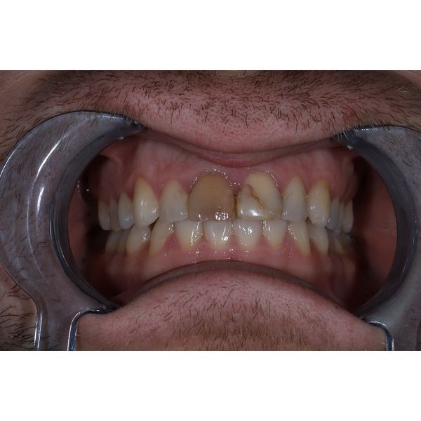 Второе посещение Второе посещение