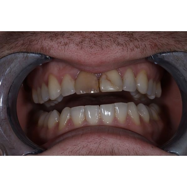 До лечения До лечения