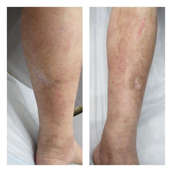 Контрольный осмотр, август 2021 года